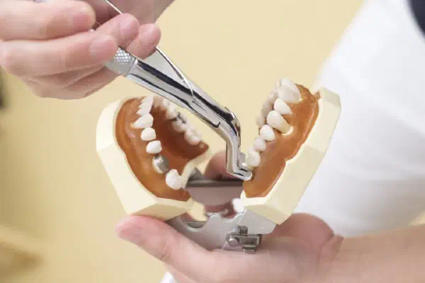 Your Complete Guide to Tooth Extraction: What to Expect and How to Heal