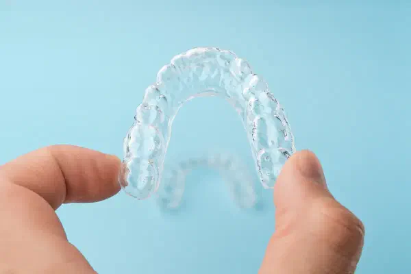 What Are Vivera Retainers? Everything You Need to Know