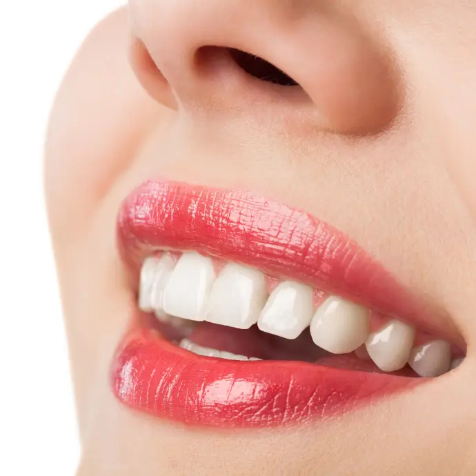 Bright, healthy smile after professional whitening