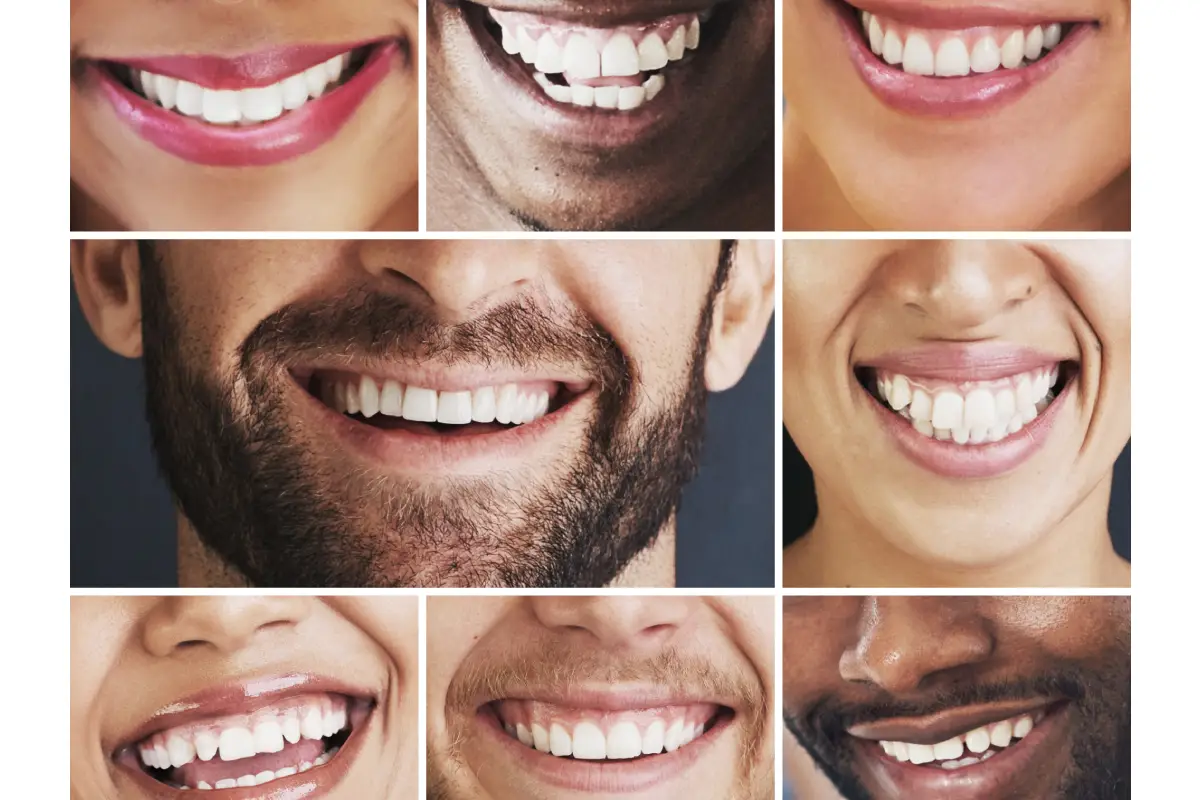 Achieve a Brighter Smile with Professional Teeth Whitening in Del Rey Oaks