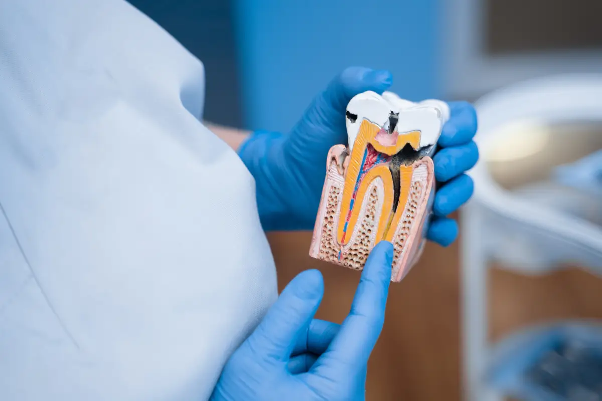 a dentist inspecting a teeth